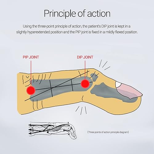 Miniatura 5 de 2 piezas de férula de dedo mazo soporte de dedo férula de dedo soporte protector de plástico para inmovilizador de dedos ajustable para protección