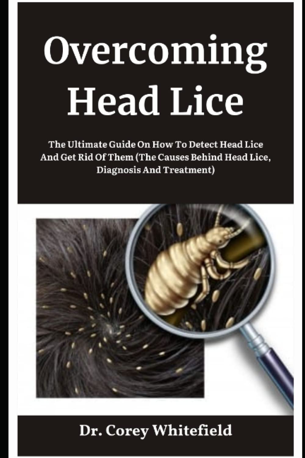 Buy Head Lice The Ultimate Guide On How To Detect Head Lice