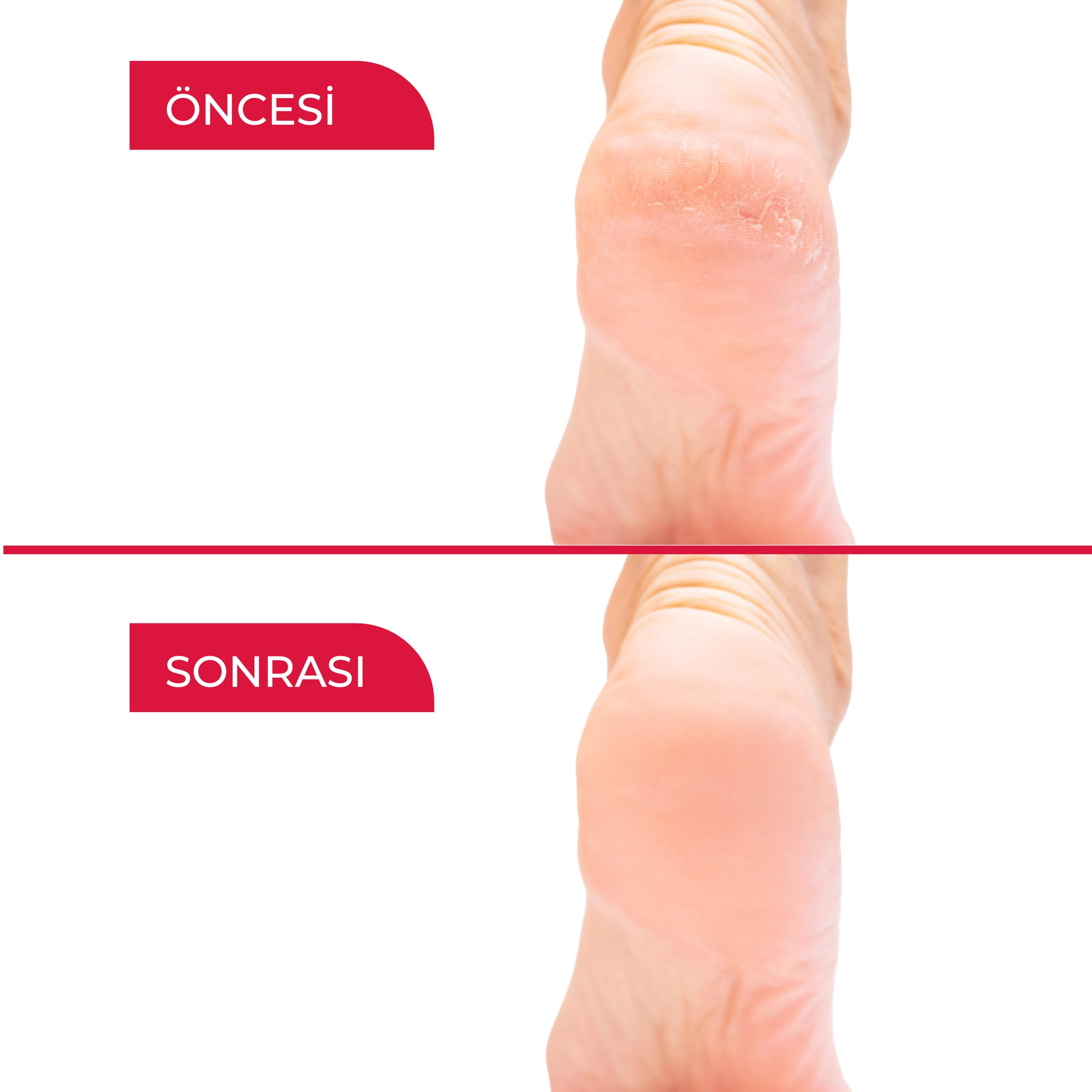 Muvilab Ayak ve Topuk Çatlak Kremi, Yoğun Nemlendirici, Koku Önleyici, Sertleşmiş Topuklar için Onarıcı Bakım Kremi