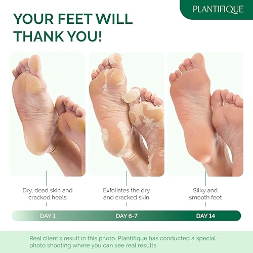 Miniatura 2 de PLANTIFIQUE Mascarilla exfoliante para pies, paquete de 2 para hombres Dermatológicamente probada, repara talones y elimina piel seca muerta