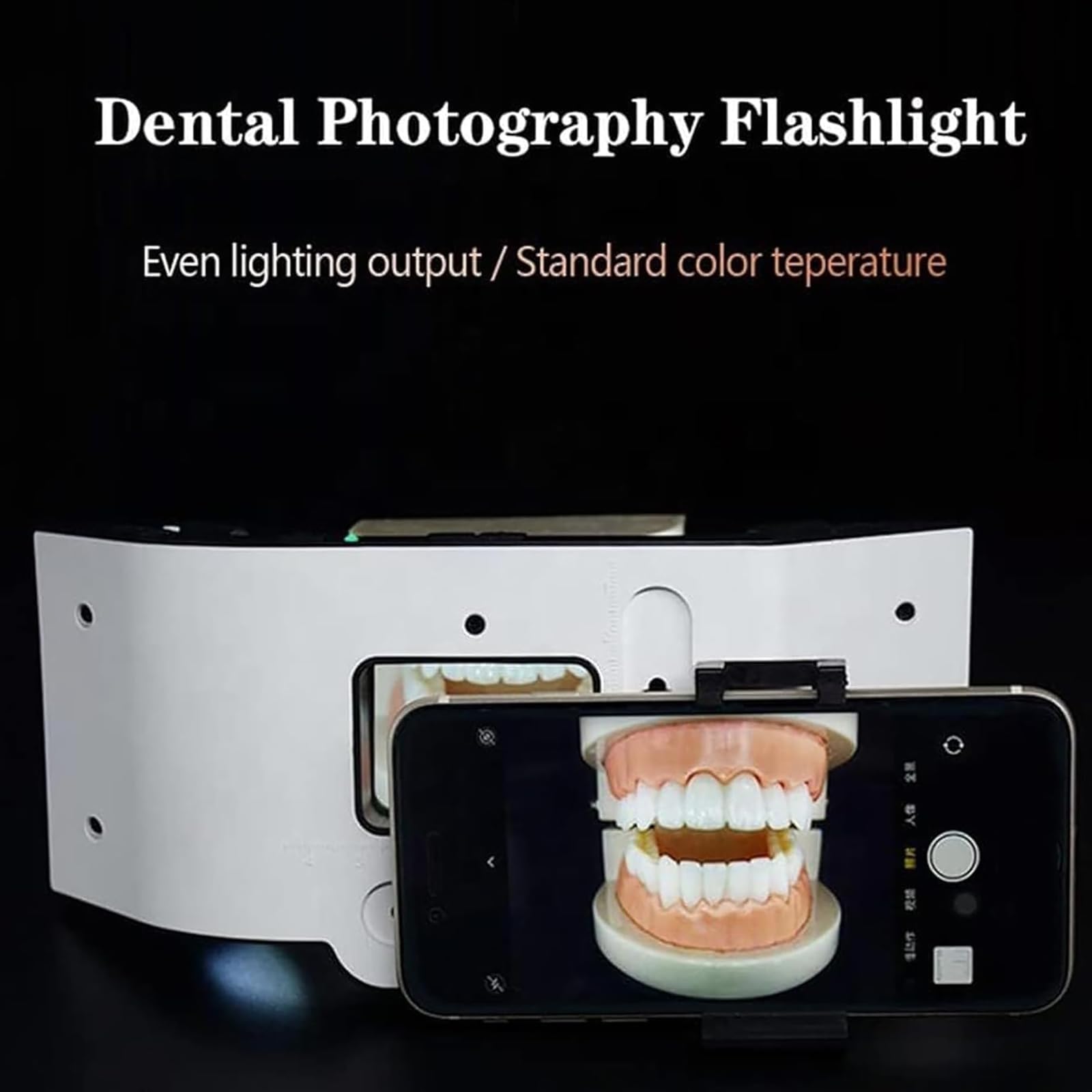 Luz de fotografía dental móvil, control de brillo de 3 engranajes, soporte extraíble para tratamiento de odontología, clínicas, hospitales