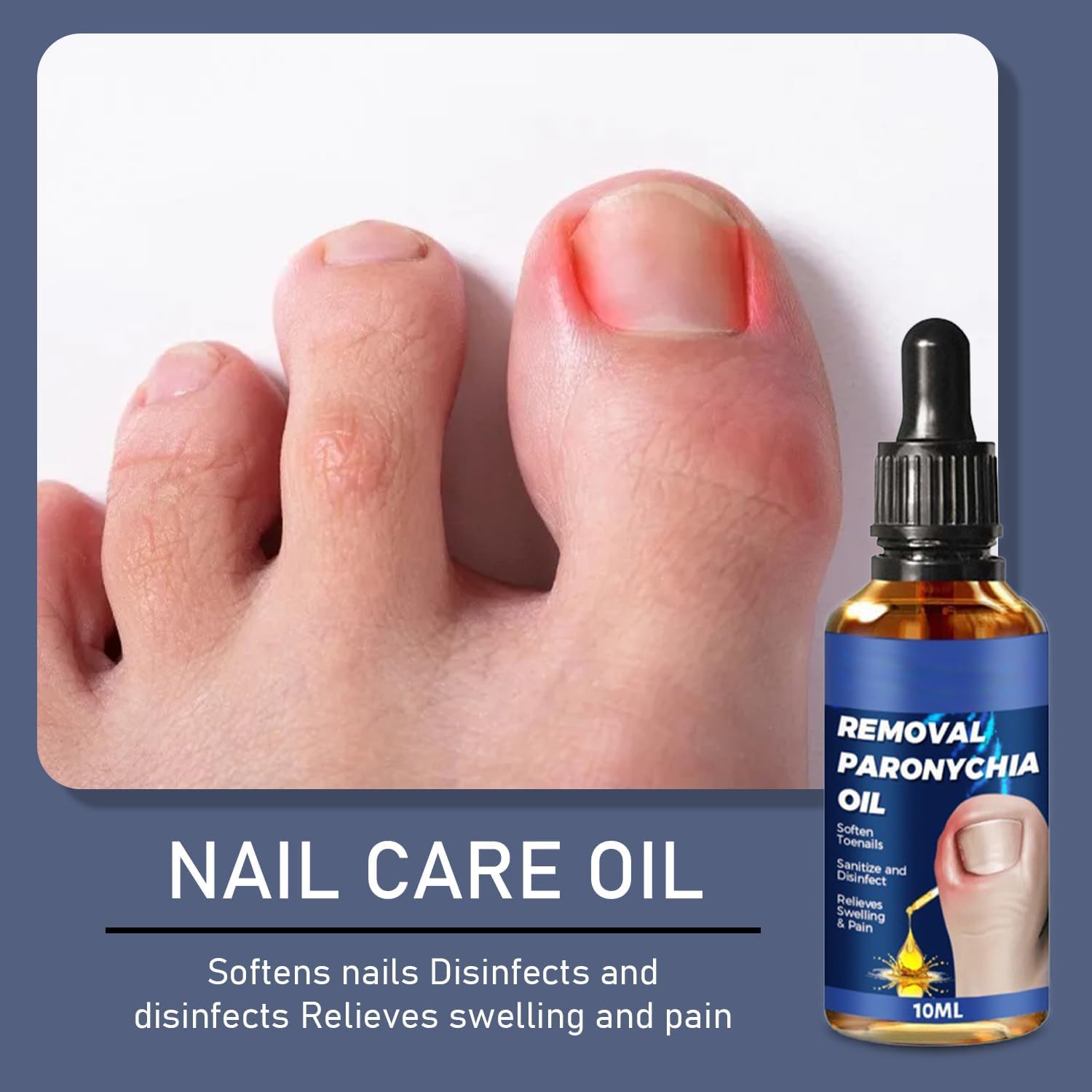2 PCS Ingrown Toenail Care Oil, Softening Toe Nail Solution for Easy Trimming, Gentle Formula for Nail Edges - Image 2