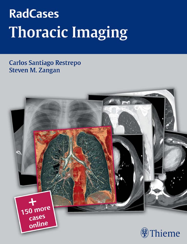 健康・医学 the thorax Radcases Thoracic Imaging (Radcases Plus Q&A): 9781604061871