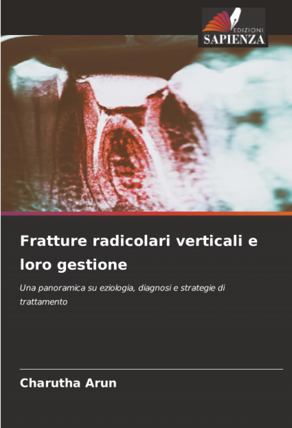 Fratture radicolari verticali e loro gestione: Una panoramica su eziologia, diagnosi e strategie di trattamento