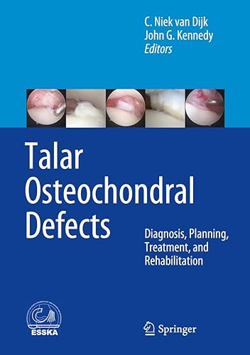 Talar Osteochondral Defects: Diagnosis, Planning, Treatment, and Rehabilitation
