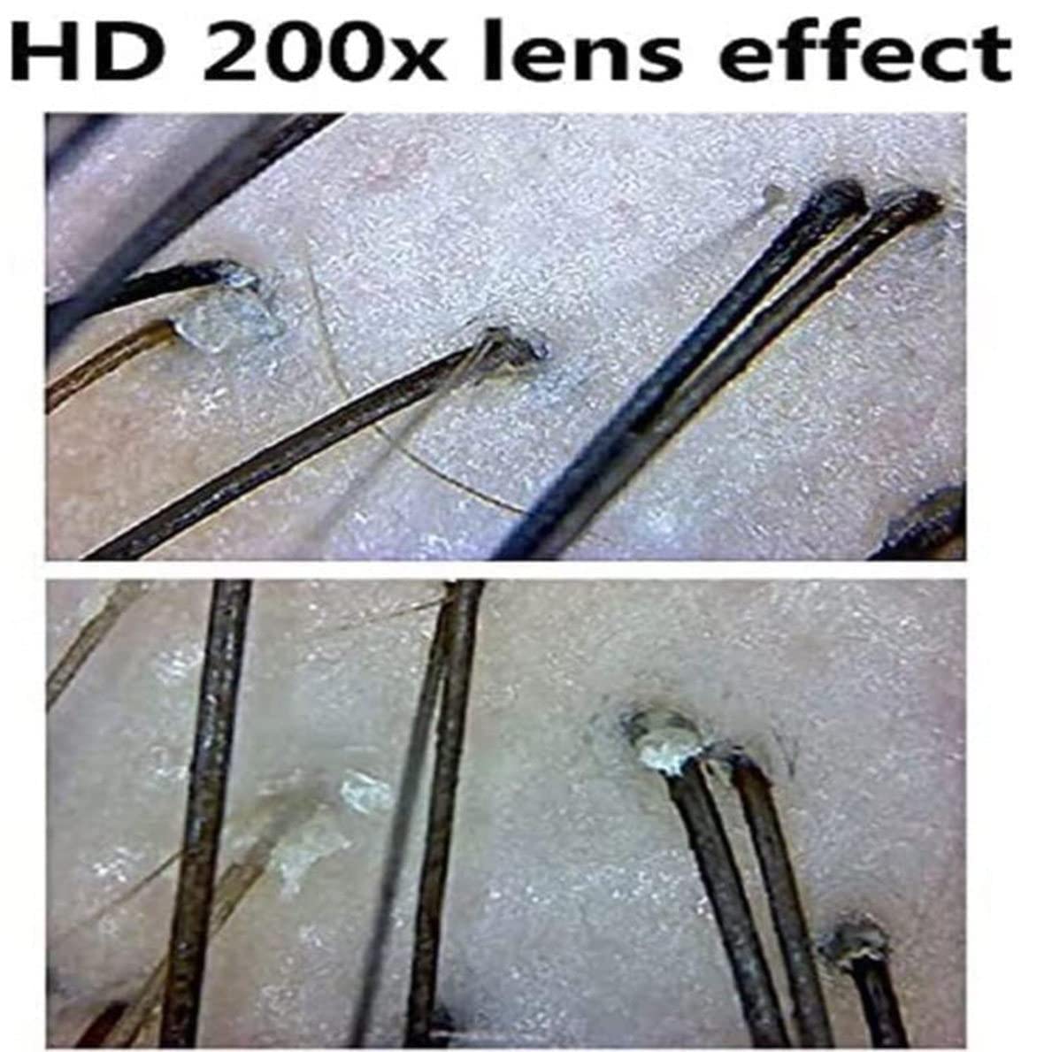 10-Zoll-LCD-Bildschirm Kopfhaut-Haarfollikel-Haar-Haut-Analysegerät, Multifunktionales Haarfollikel-Haut-Analysegerät Einfache Bedienung Für Die Wiederaufladbare Analyse Der Kopfhaut