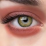 NVIDRLENS