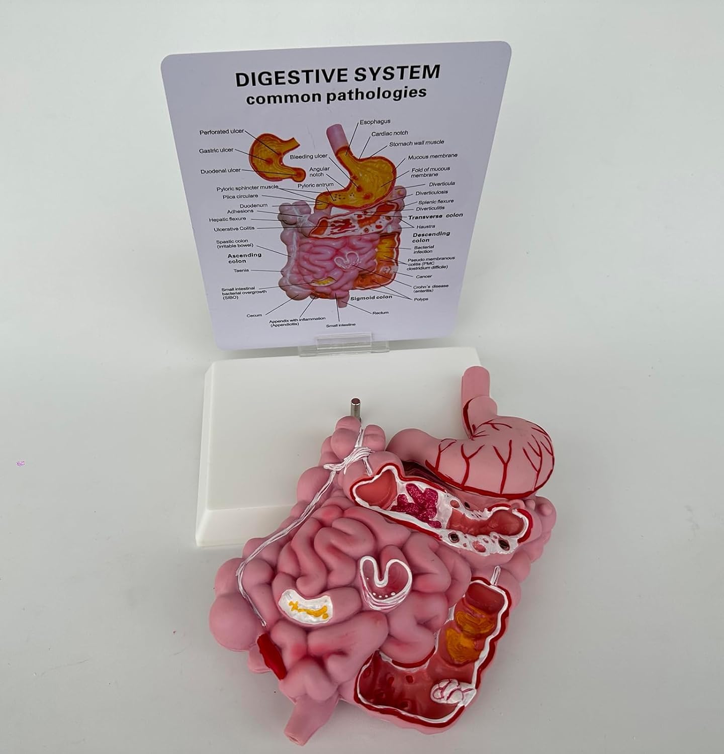 Model układu pokarmowego człowieka, model dydaktyczny przekroju żołądka, wyjmowany model anatomii ludzkiego żołądka, obejmuje przewód pokarmowy i okrężnicę, odpowiedni do wspomaganej nauki.