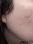 LivaClean 272 CT Large Pimple Patches for Face - Variety Pack Zit Patches w/ Salicylic Acid, Tea Tree, Calendula Oil - Pimple Patches Large Acne Patches for Face and Body - Dark Spot Patches