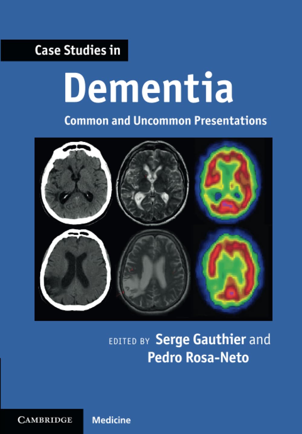 Case Studies in Dementia