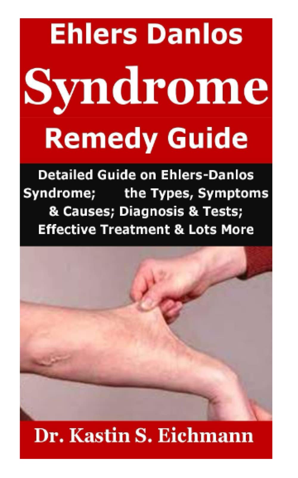 Ehlers-Danlos Syndrome Remedy Guide: Detailed Guide on Ehlers-Danlos Syndrome; the Types, Symptoms & Causes; Diagnosis & Tests; Effective Treatment & Lots More