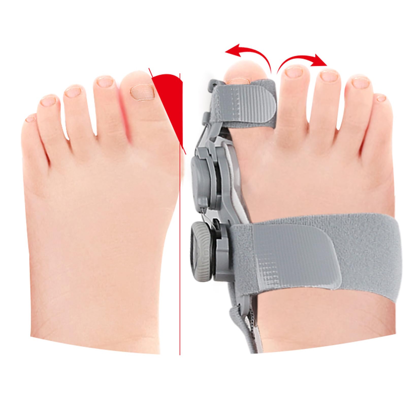 Kinder-Ballenbehandlung, Verstellbare große Zehen-Schiene zur Korrektur des Hallux Valgus, Ballen-Splint, Zeigengerade mit Silikon-Pad Ballenentlastung für Mädchen und Jungen