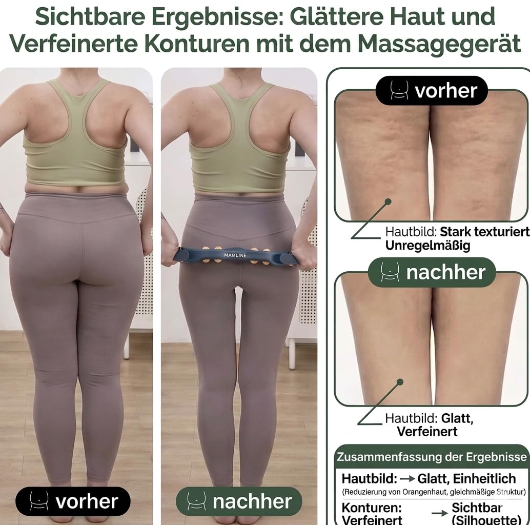 Anti-Cellulite Massagegerät mit Trockenbürste – Manuelles Faszienmassage Set für Beine, Po, Bauch & Arme – Hautstraffung & Lymphdrainage – Inklusive Baumwollbeutel