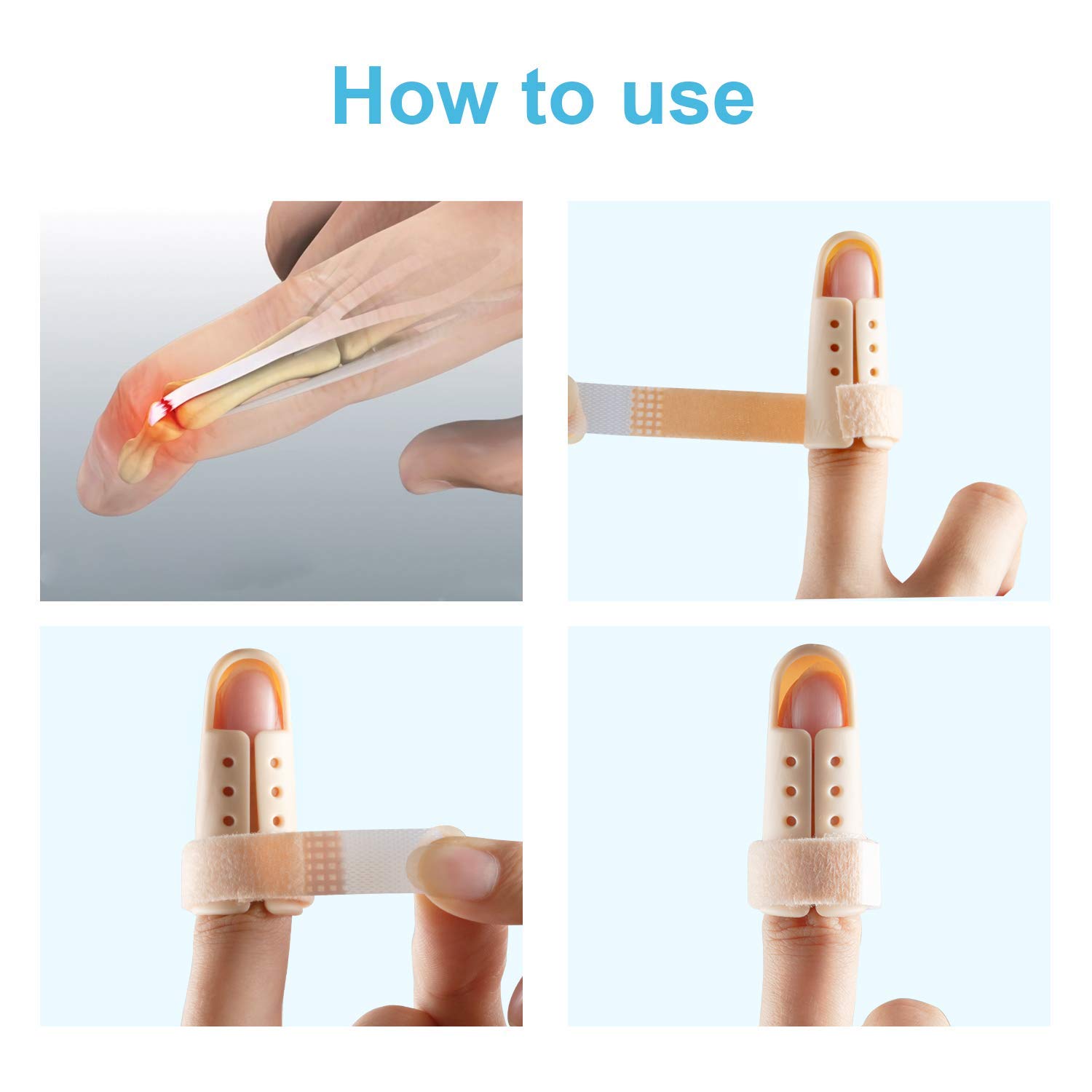 Sumifun Stack Splints, 5 PCS Finger Splint for Pinky, Slim Finger