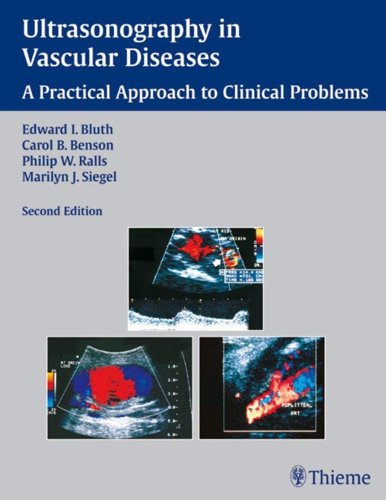 Buy Ultrasonography in Vascular Diseases — BookShops.in