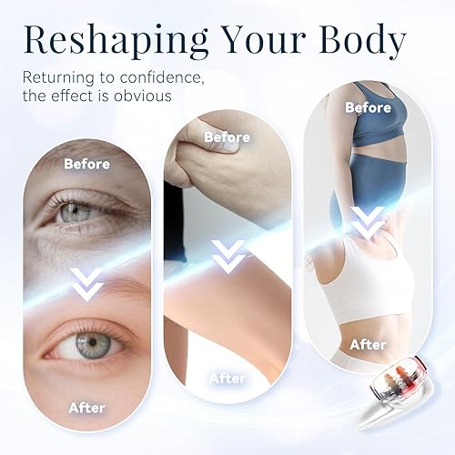 Miniatura 3 de Sculpiflex - Máquina de celulitis Sculpiflex, kit completo Sculpiflex 3 en 1, Sculpiflex - Kit básico de esculpir, eliminación de la celulitis y