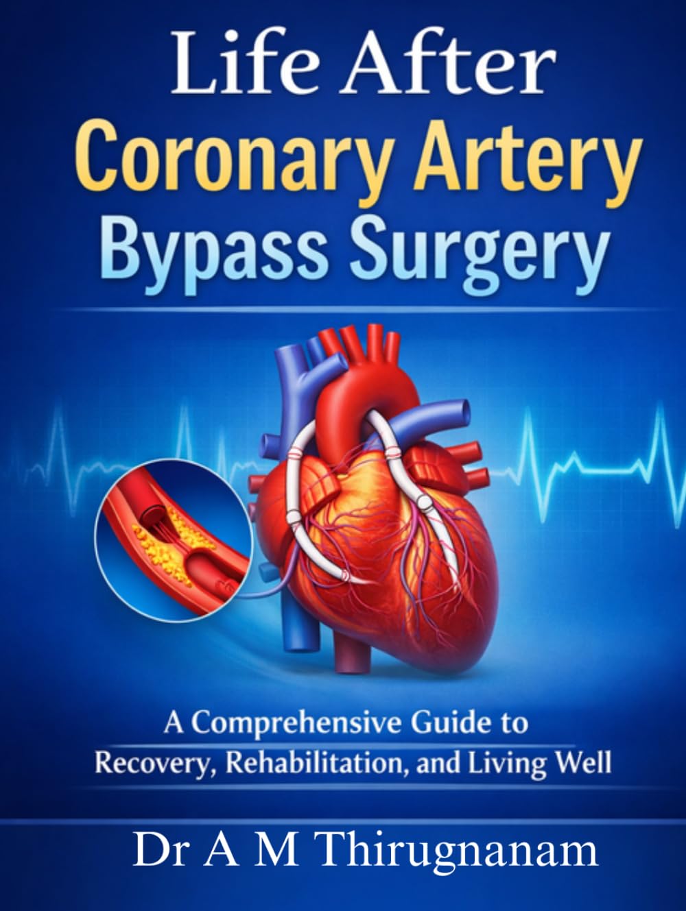 Life After Coronary Artery Bypass Surgery: A Comprehensive Guide to Recovery, Rehabilitation, and Living Well