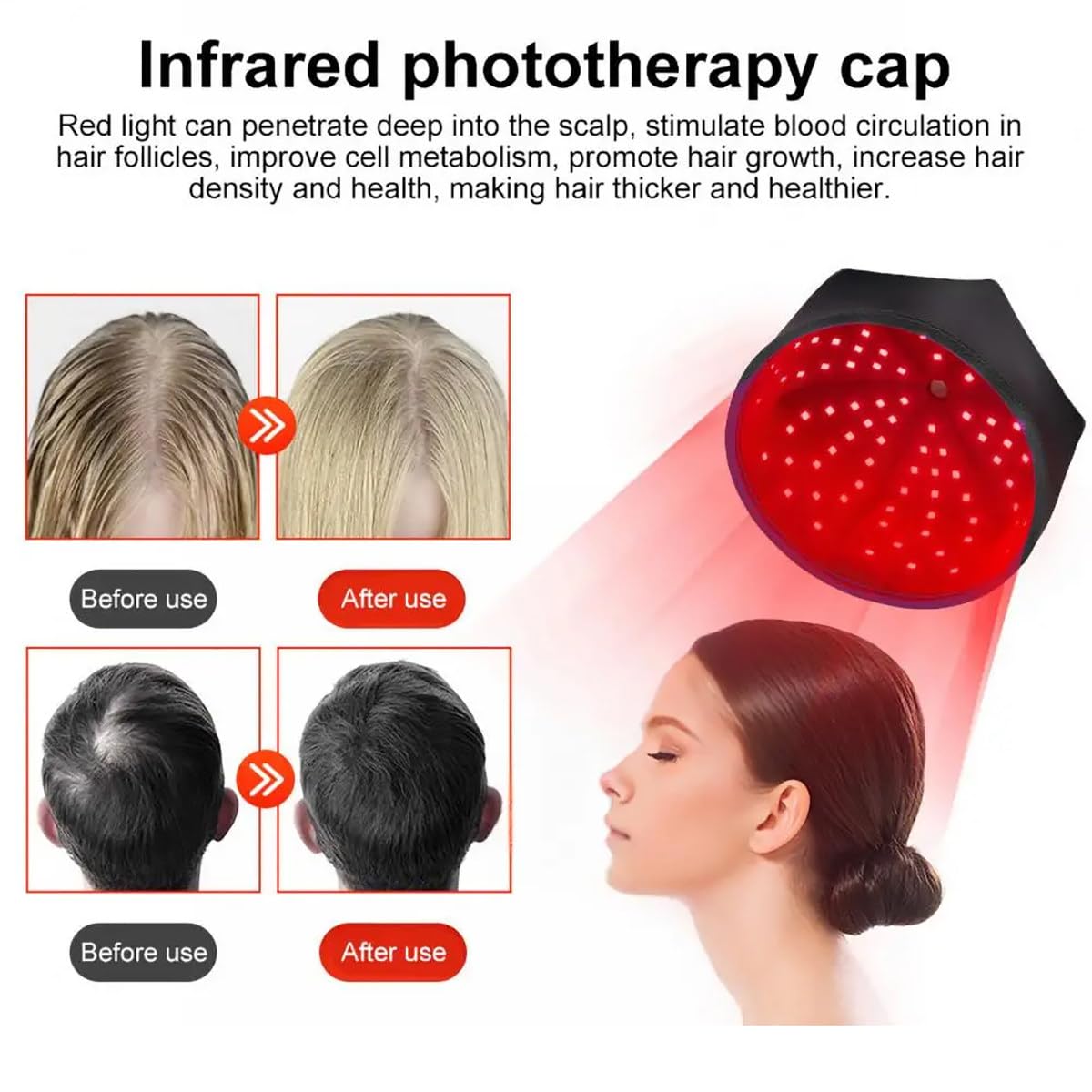 Hair Growth Cap, Casco Para El Crecimiento Del Cabello, Gorro De Crecimiento Del Cabello De Doble Longitud De Onda De 660 Nm Y 850 Nm Con 120 Led, Mejora La Salud Del Cuero Cabelludo,Black