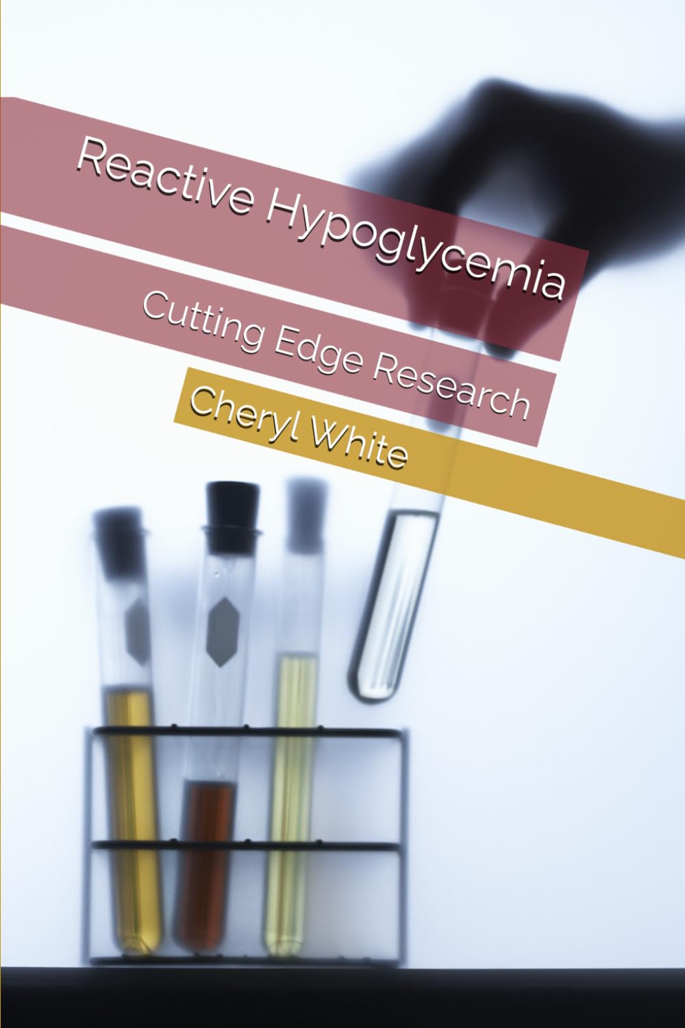 Reactive Hypoglycemia: Cutting Edge Research