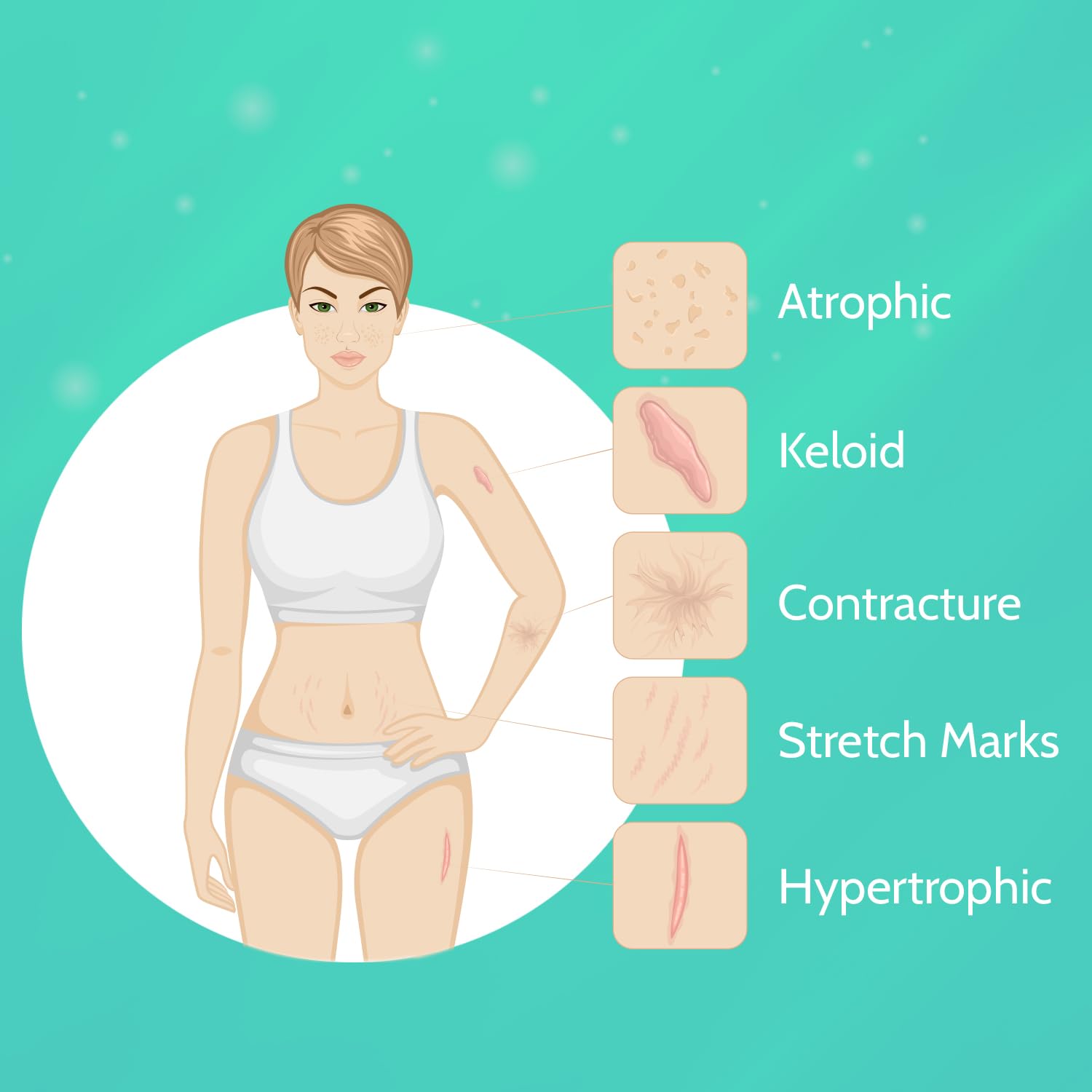 Scar Cream for Keloid Bump Removal: Professional Silicone Gel for Keloids, Acne Scars, Stretch Marks, C-Section & Burn Marks – Old & New Scar Care Treatment, 1 oz - Image 4