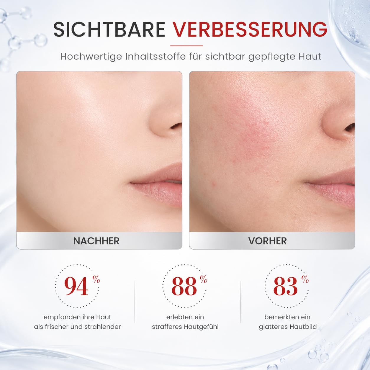Koriderm Cream Hyaluron Feuchtigkeitscreme Für Gesicht Augenpartie Hals Und Tägliche Hautpflege (50ml *1)