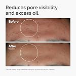 The Ordinary Niacinamide 10% + Zinc 1%, Sérum lissant pour la peau à prone blemish, 30 ml