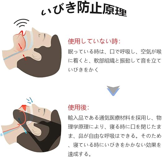 Amazon Zyou 19改良版 いびきサポーター いびき防止グッズ 口呼吸防止テープ 抜群な伸縮性 通気性 肌に優しい おやすみサポーター 顎固定サポーター サイズ調整可能 男女兼用 Zyou 睡眠用マウスピース