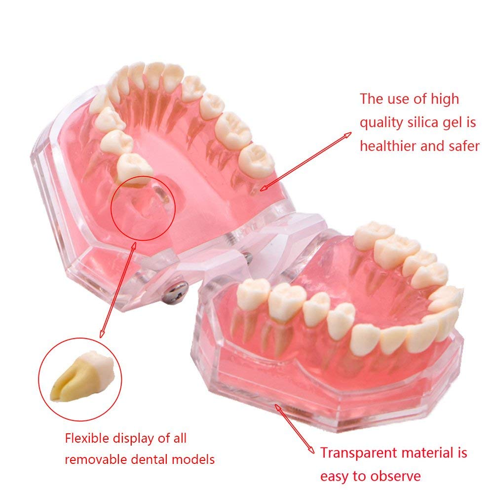 Modello didattico, Modello di Studio per impianti dentali, Modello Standard con Denti Rimovibili, Strumento di Studio didattico per Studenti di odontoiatria, pa