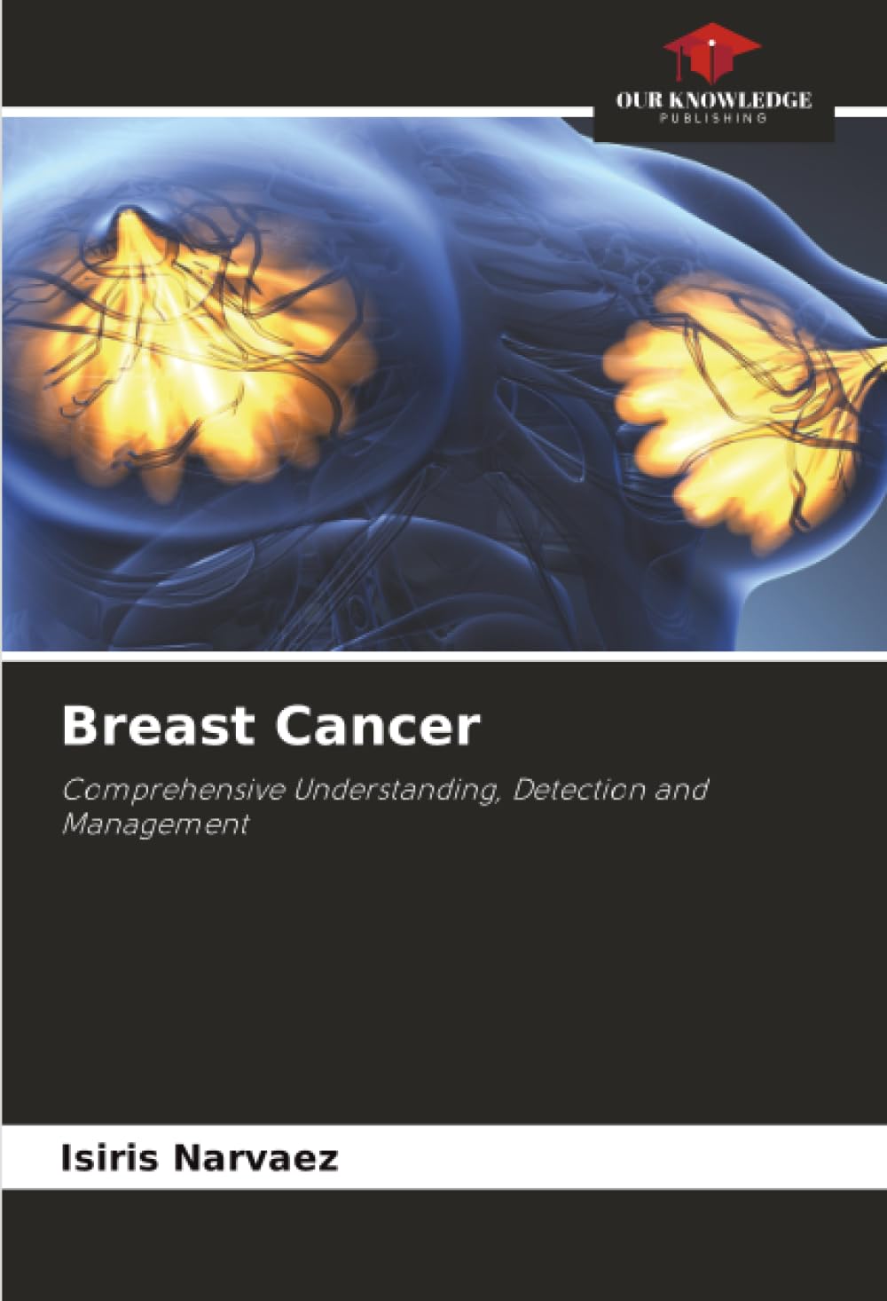 Breast Cancer: Comprehensive Understanding, Detection and Management