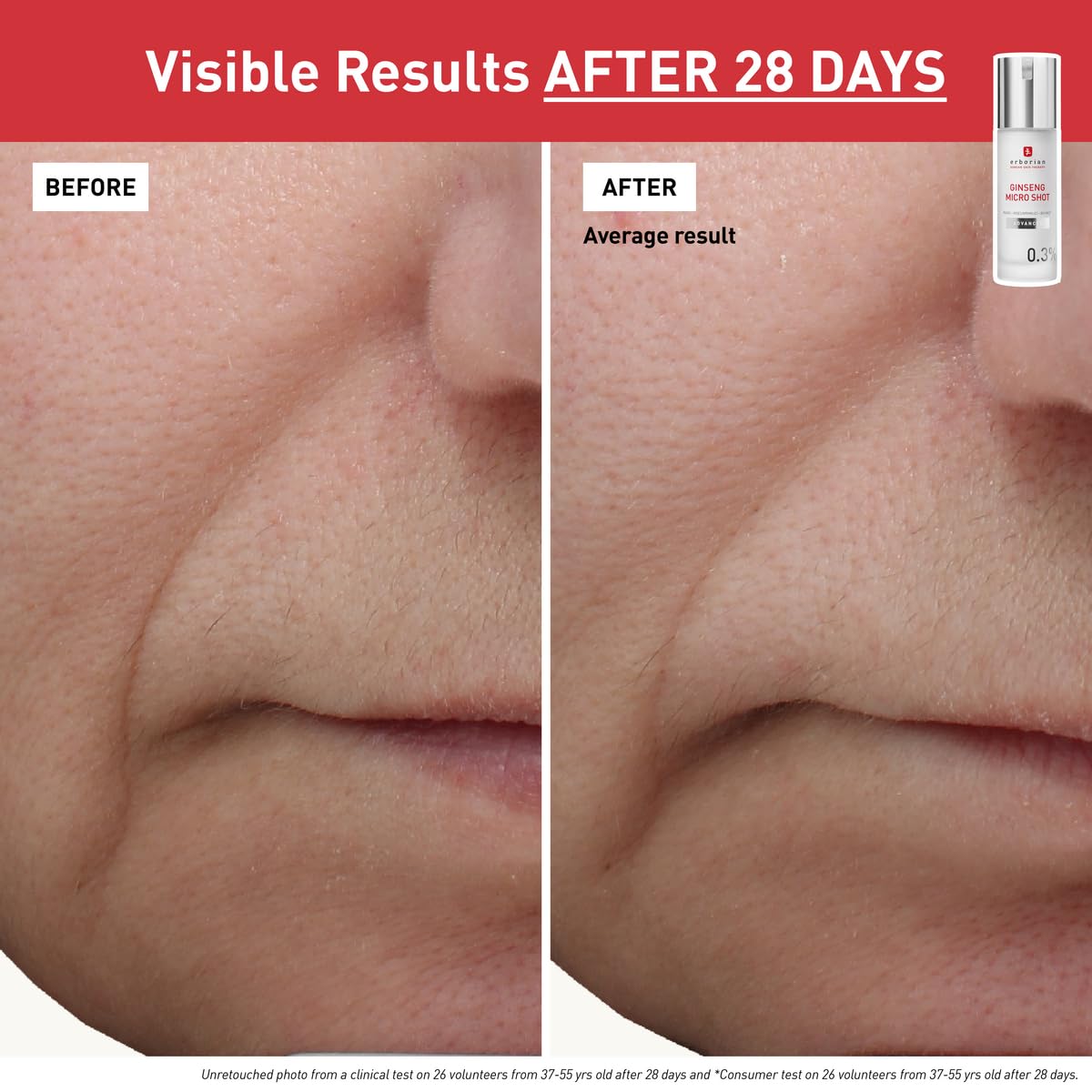 Erborian Ginseng Micro Shot Serum, Microneedling Face Treatment, Pore Refining, Texture Smoothing, Collagen Boosting, Skin Renewal, Korean Skincare