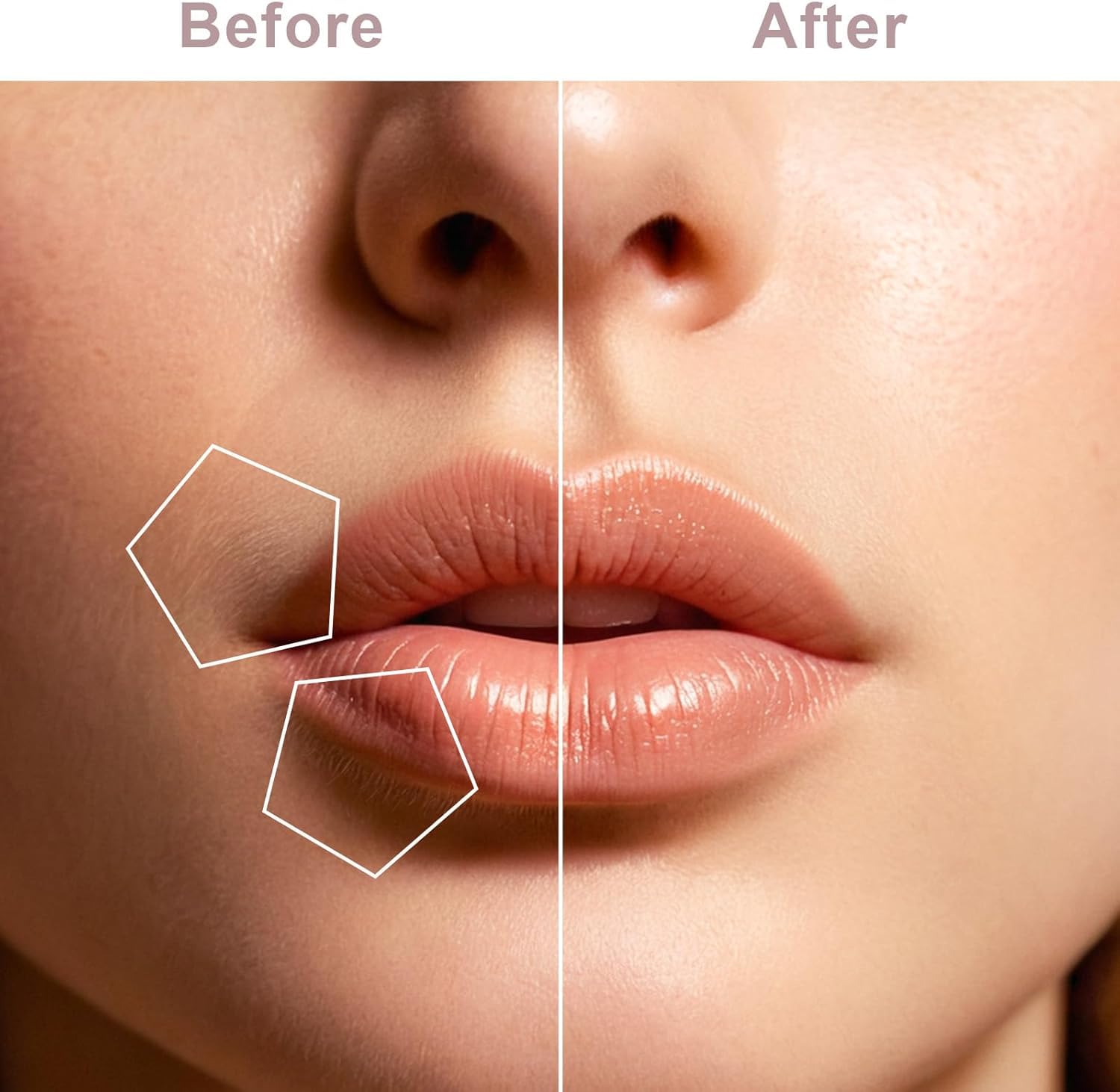 Feelon Facial Epilator Hair Removal Machine For Women - Face, Chin, Cheek, Eyebrow, Upper Lip Hair Remover For Women, Usb Rechargeable Epilator Machine 1