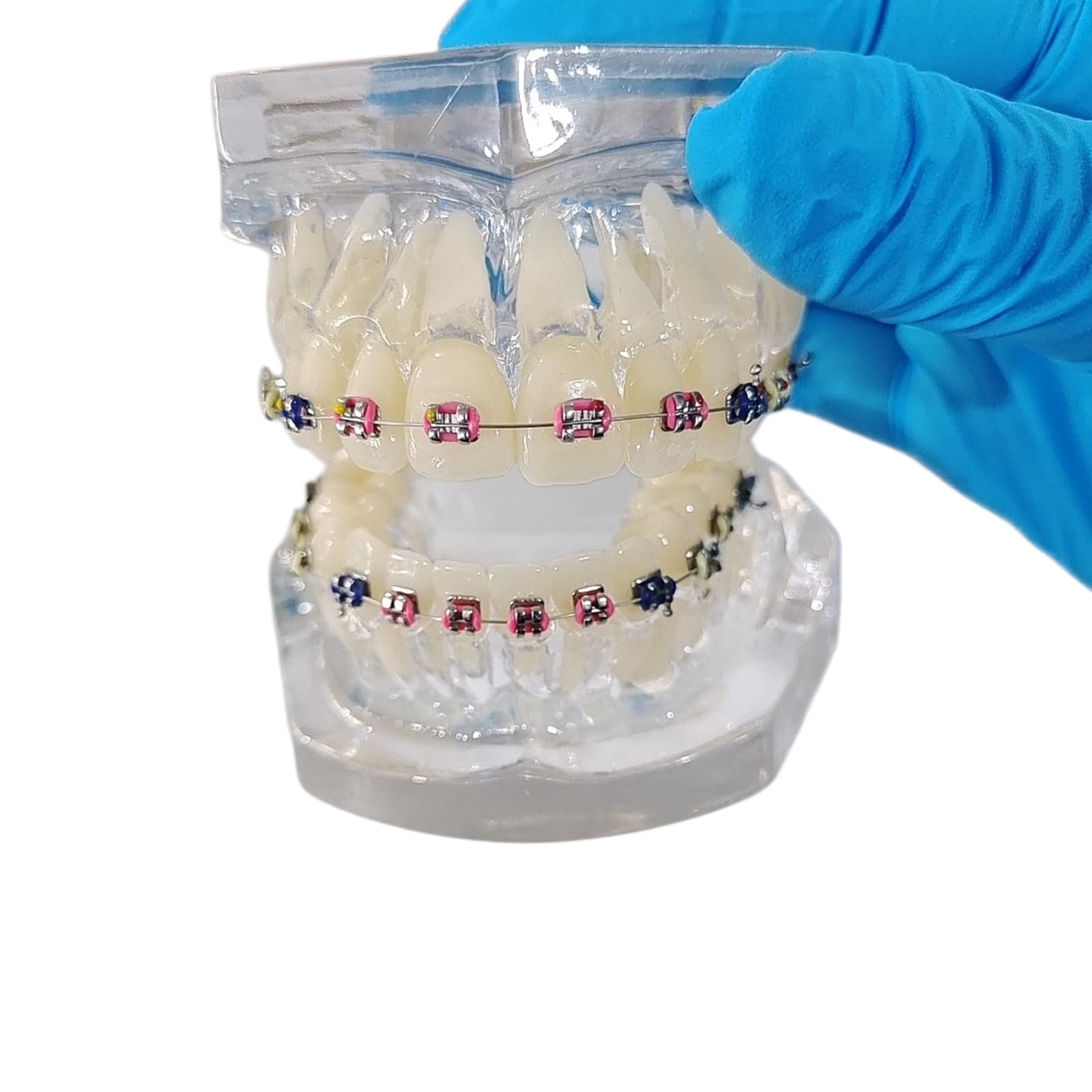 Modello Ortodontico Dentale, Modelli Dentali con Apparecchi Metallici Trasparenti, per Insegnare la Comunicazione Medico-Paziente