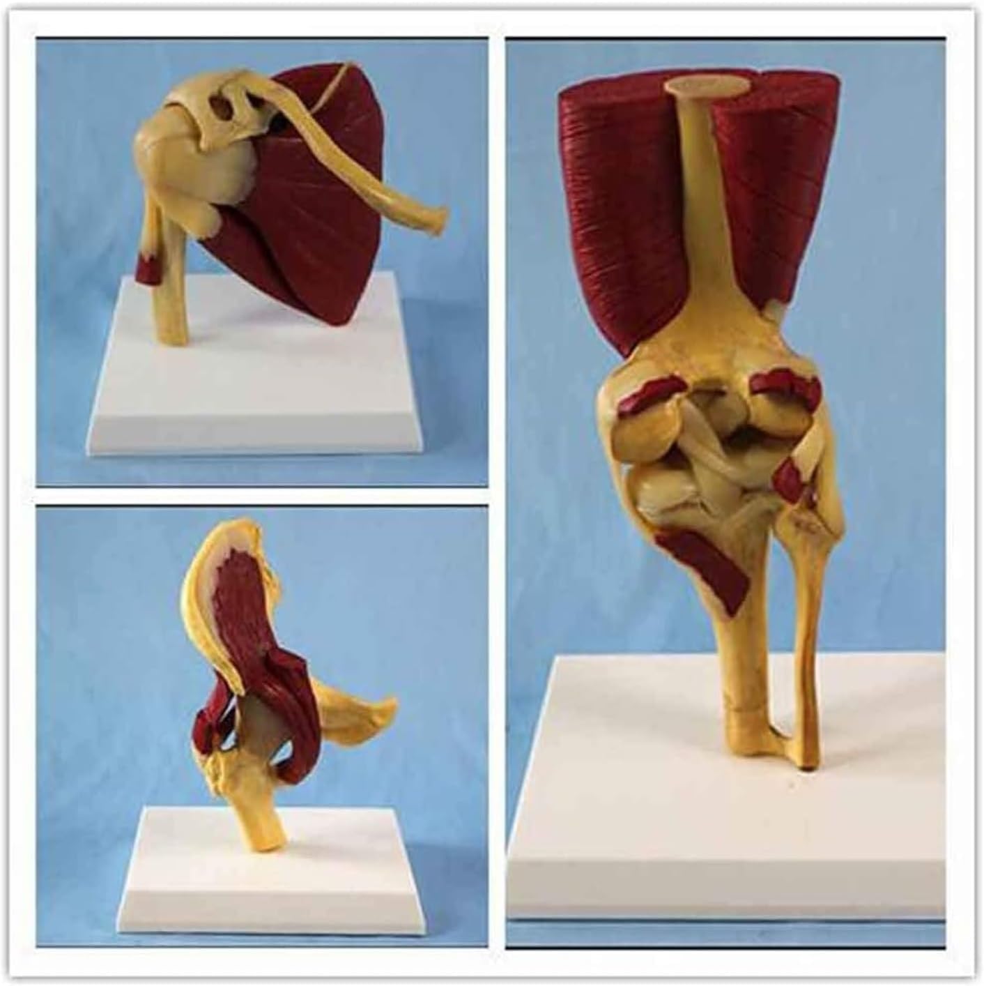 Model Anatomiczny Stawu Biodrowego Człowieka Odzwierciedla Związek Między Ludzką Kością Udową A Miednicą I Mięśniami. Narzędzie Edukacyjne Modelu, Multi-colored, 22cm