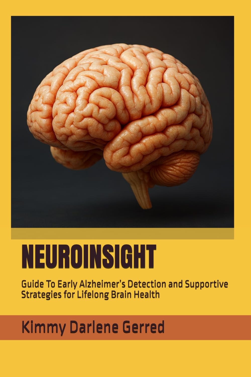 NEUROINSIGHT: Guide To Early Alzheimer’s Detection and Supportive Strategies for Lifelong Brain Health