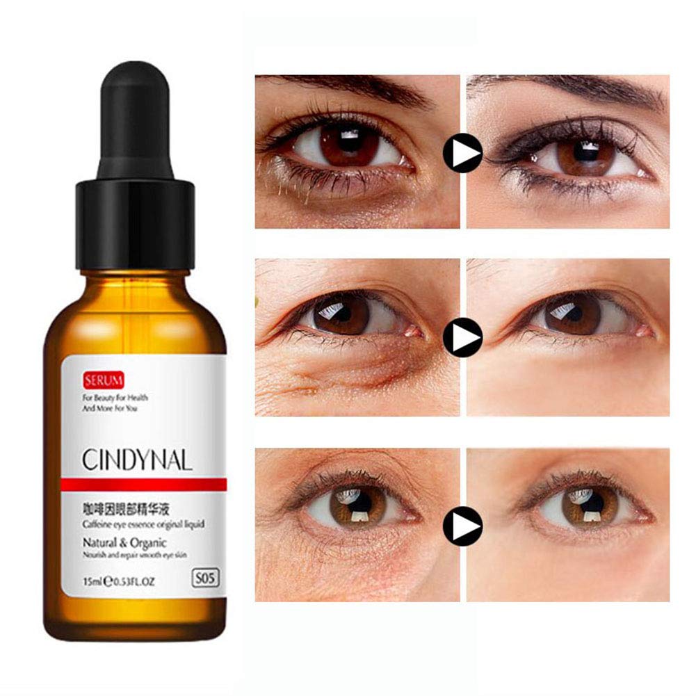 serum for eyebags