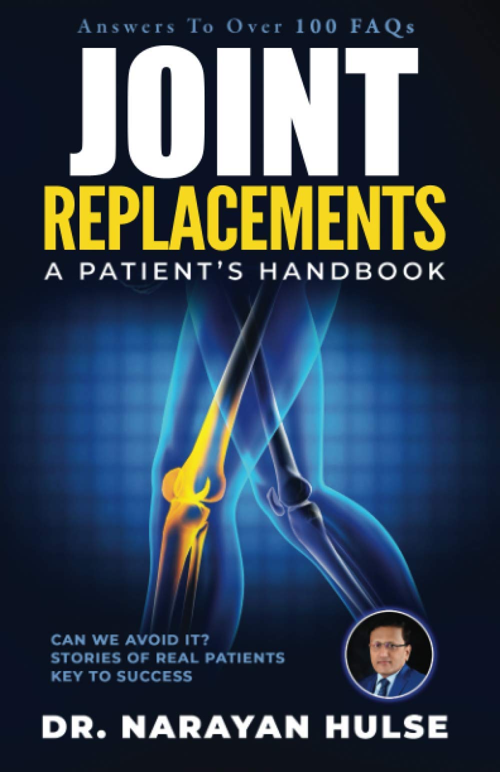 JOINT REPLACEMENTS