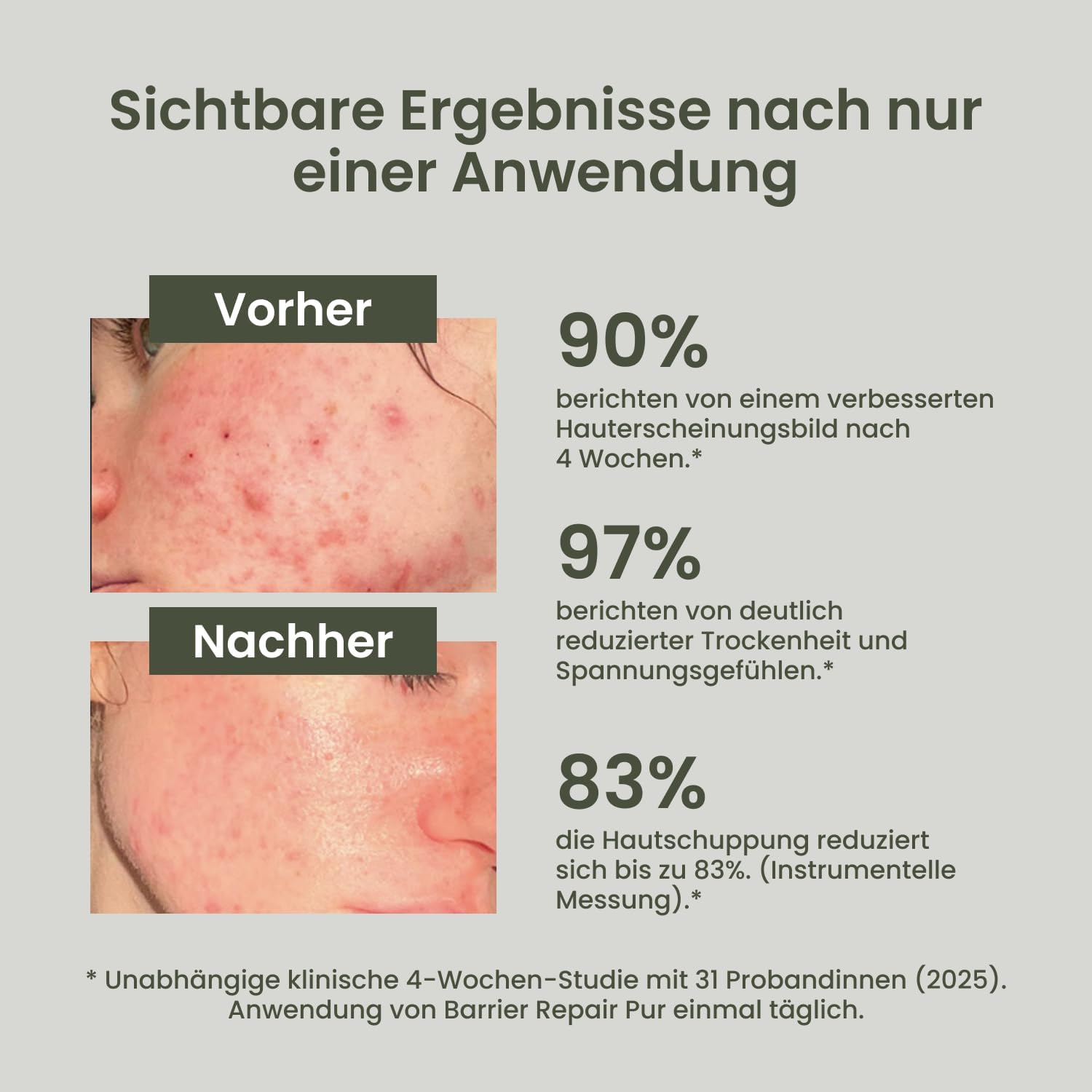 TALLOW Naturals Barrier Repair Lavendel – BEKANNT AUS DER HÖHLE DER LÖWEN - Rindertalg Creme mit Lavendelöl, Bio Beef Tallow Skincare, Hautpflege aus Deutschland von grasgefütterten Rindern (120ml)