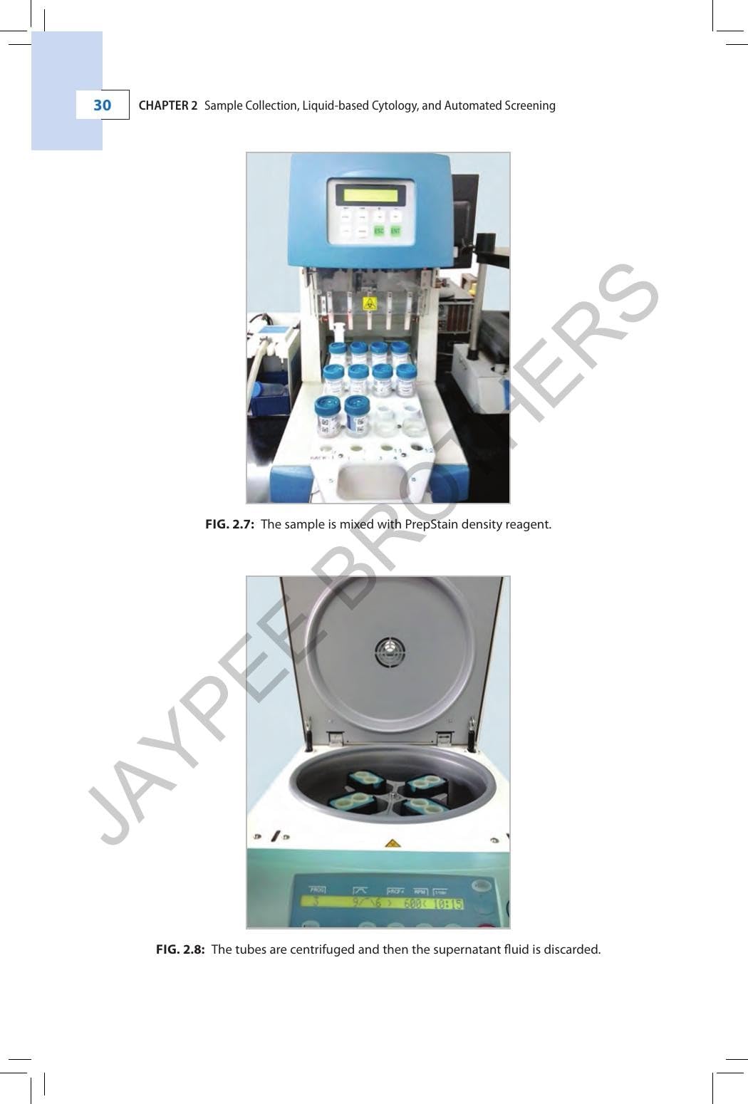 Cervical Cytology: Special Emphasis on Liquid-based Cytology