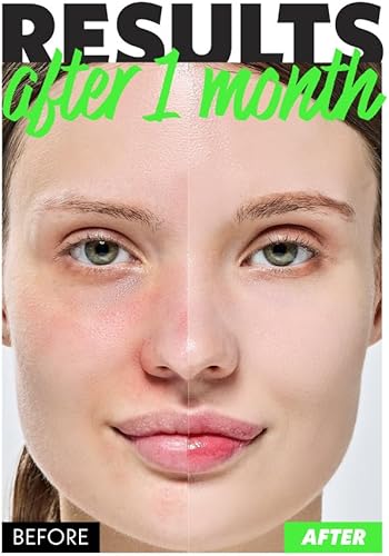 Miniatura 8 de Fation Nosca9 Soothing Toner S | Tónico exfoliante 2% PHA y LHA para pieles sensibles | Hidratante, hipdrante y de rápida absorción coreana (paquete