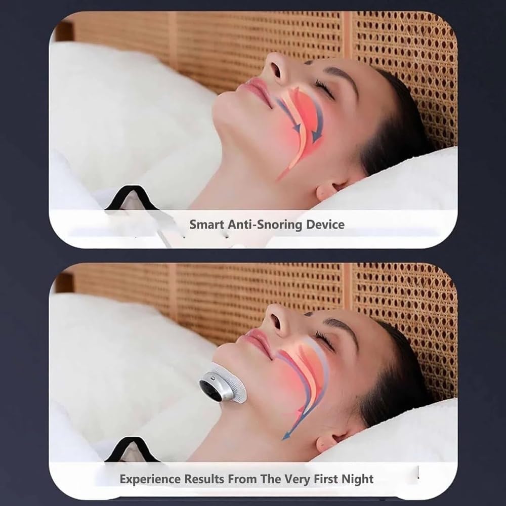 Z3 Pro - Professional Anti-Snoring Device, Z3 Pro Snoring Solution, NovaNord Z3 Pro Snoring Solution, Fast and Effective Smart Z3 Pro Sleep Device, 3-Speed Adjustment，Sleep Soundly(2pcs)