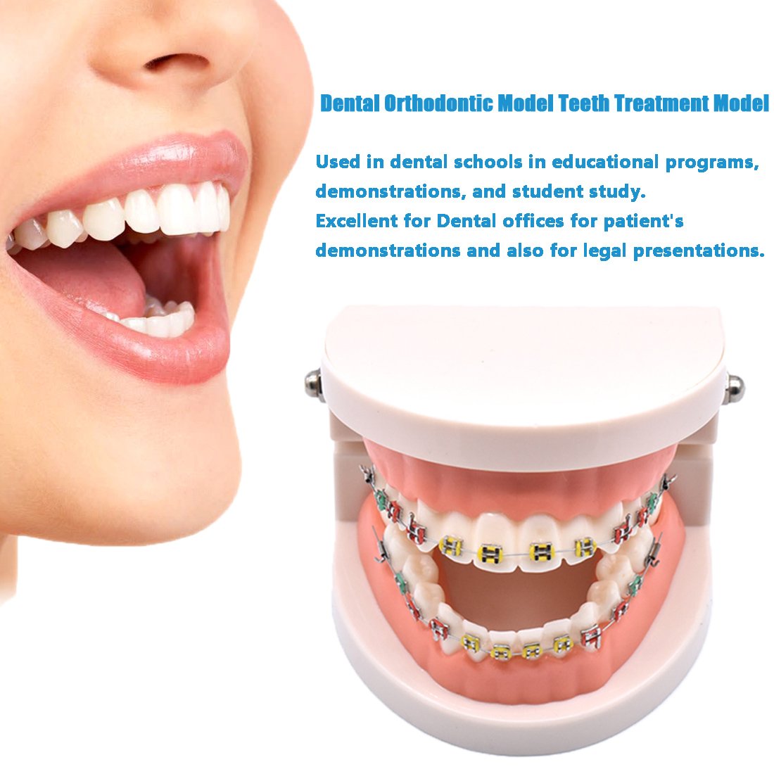 Angzhili 1 Piece Dental Demonstration Orthodontic Model with Metal Wires and Bracket (Metal Bracket)