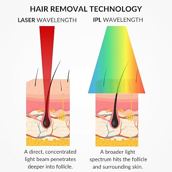 CurrentBody Skin Laser Hair Removal Device | At Home Hair Removal Treatment, Clinic Technology at Home, Full Body Hair Reduction for Underarms, Legs, Bikini, Feet, Hands, Chest, Back & Stomach