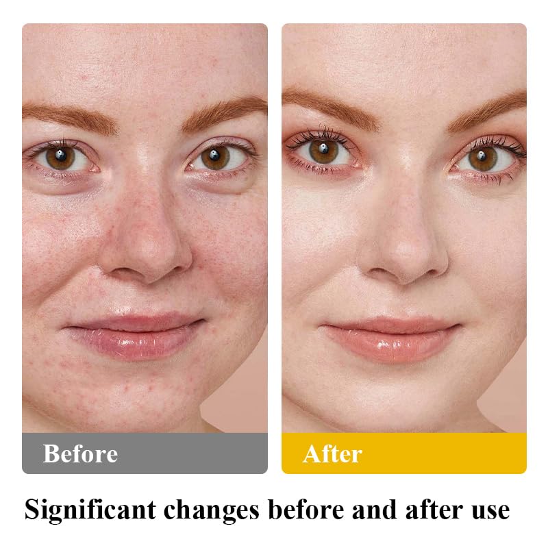 Miniatura 6 de Sarga de ternera para la piel, sebo y bálsamo de miel, crema hidratante facial de ternera alimentada con hierba, ingrediente totalmente natural,