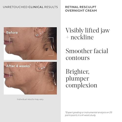 Miniatura 3 de Murad Retinal ReSculpt Crema de noche  Crema antienvejecimiento para cara y cuello con retina encapsulada y NAD+  Firme, levanta e hidrata la piel