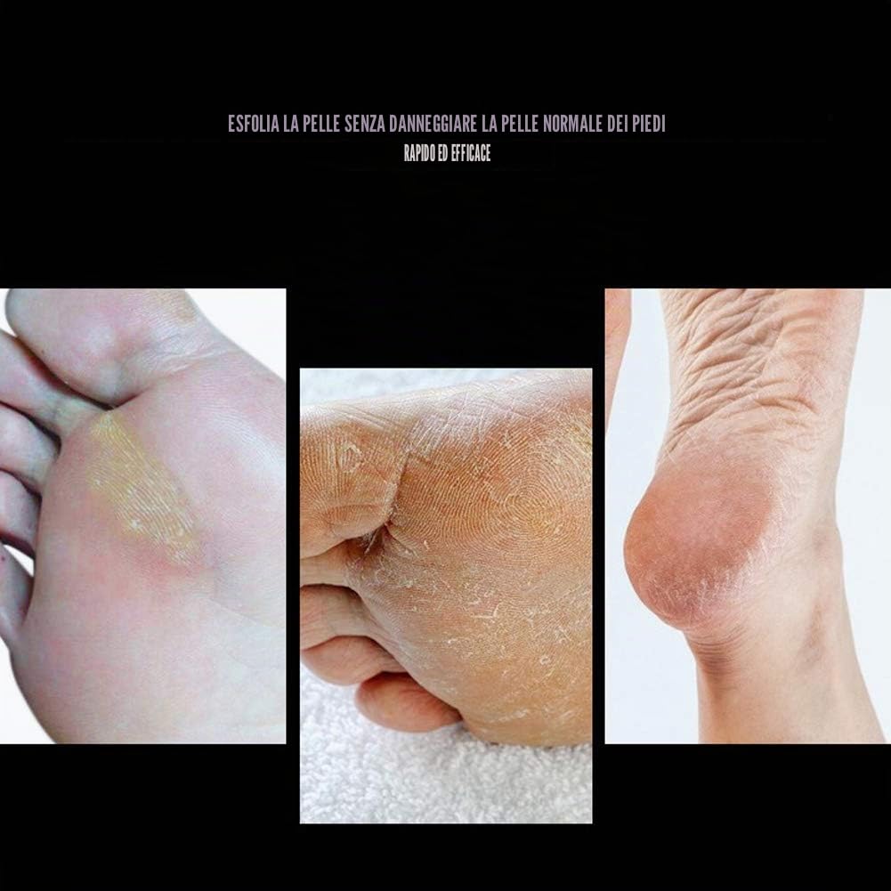 Punta a cono diamantata per pedicure, punta per trapano per unghie in acciaio inossidabile Punta per pedicure per calli Levigatura per levigatura dei calli per pelle screpolata Rimozione del callo, li