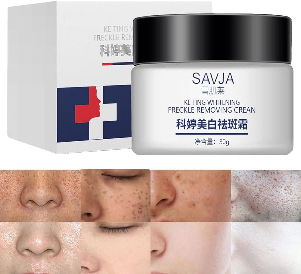 1/2/3/5pcs Dark Spot Remover For Face,Spot Cream Hyperpigmentation Treatment,Dark Spot Corrector Cream Age Spot Remover For Face,Freckle Remover For Sun Spots,Pigmentation Treatment Skincare (1pcs) 1/2/3/5pcs Dark Spot Remover For Face,Spot Cream Hyperpigmentation Treatment,Dark Spot Corrector Cream Age Spot Remover For Face,Freckle Remover For Sun Spots,Pigmentation Treatment Skincare (1pcs)