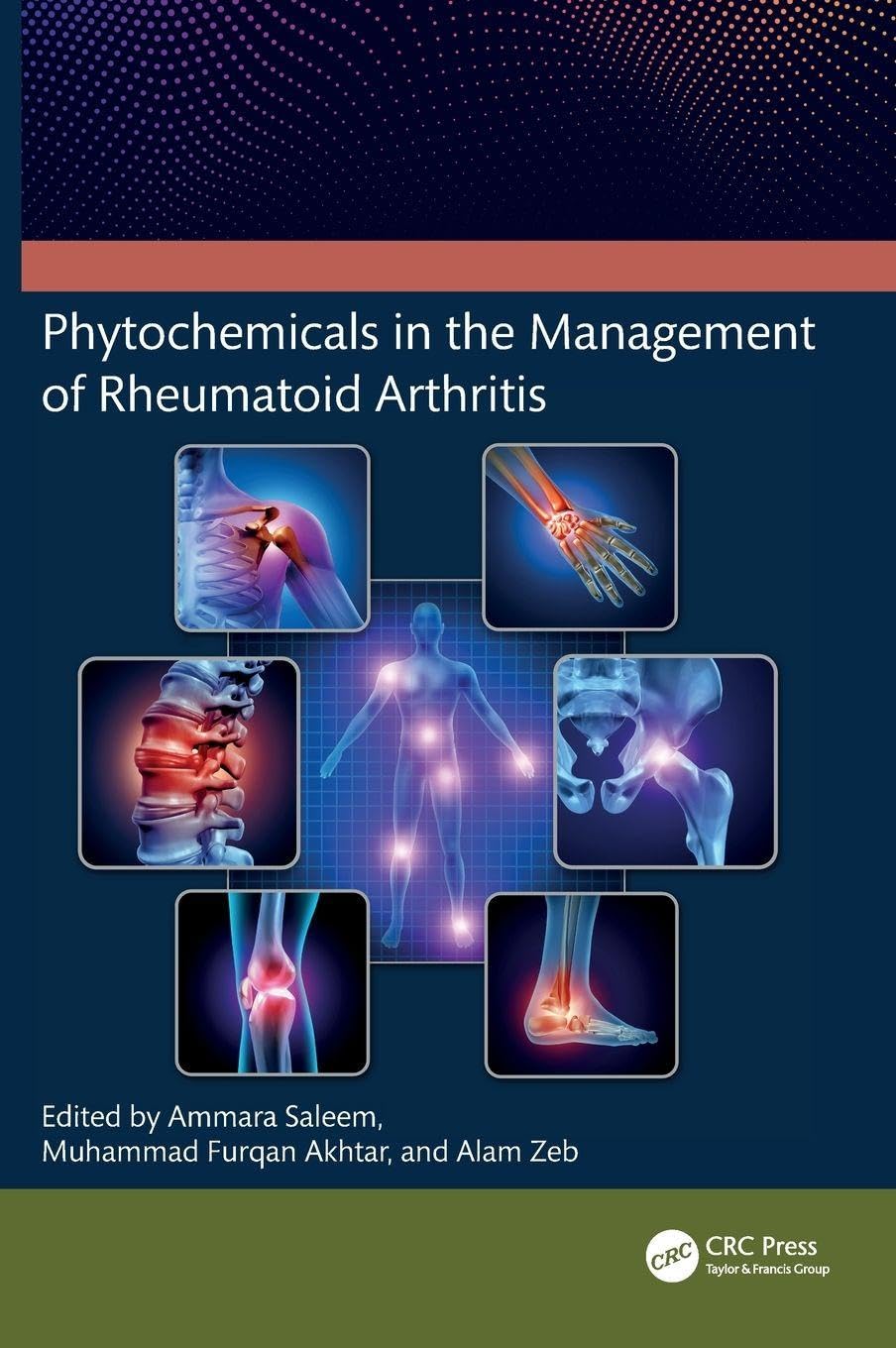 Phytochemicals in the Management of Rheumatoid Arthritis