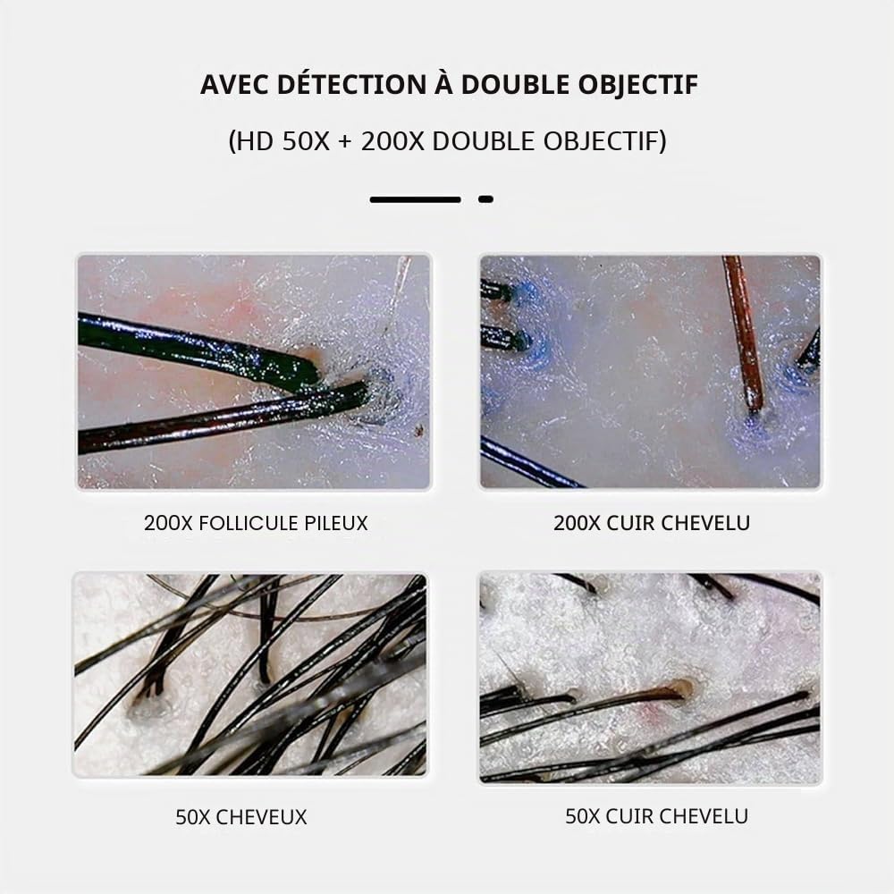 Analyseur de peau et de cheveux HD LCD de 11 pouces | Détecteur de follicules et machine d'analyse de peau tout en un à 50X/200X | Appareil multifonctionnel pour usage domestique, en salon et clinique