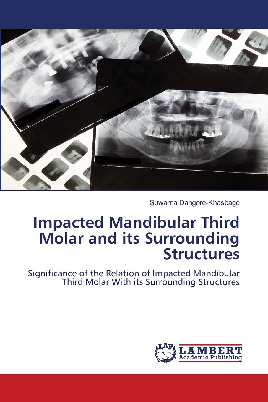Impacted Mandibular Third Molar and its Surrounding Structures: Significance of the Relation of Impacted Mandibular Third Molar With its Surrounding Structures