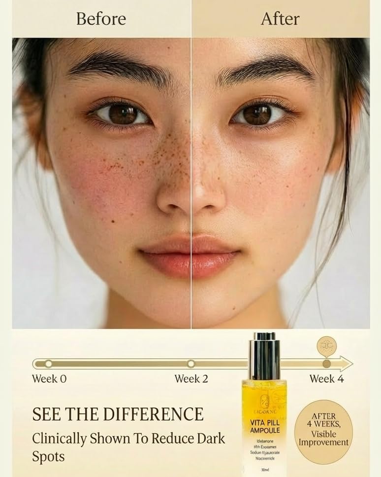 Licorne Vitafill Ampoule (1.01 fl oz) - Idebenone & Milk Exosome Antioxidant Serum for Face - Dark Spot Care & Radiant Glass Skin - Hydrating Niacinamide Essence for Anti-Aging & Uneven Tone - Image 4